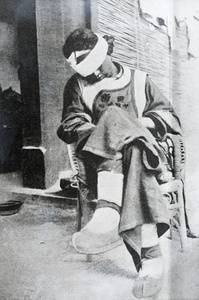 Wounded Kansu soldier (from General Dong Fuxiang's force), at the British Legation, Beijing